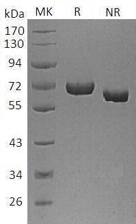 Human AFP/HPAFP (His tag) recombinant protein