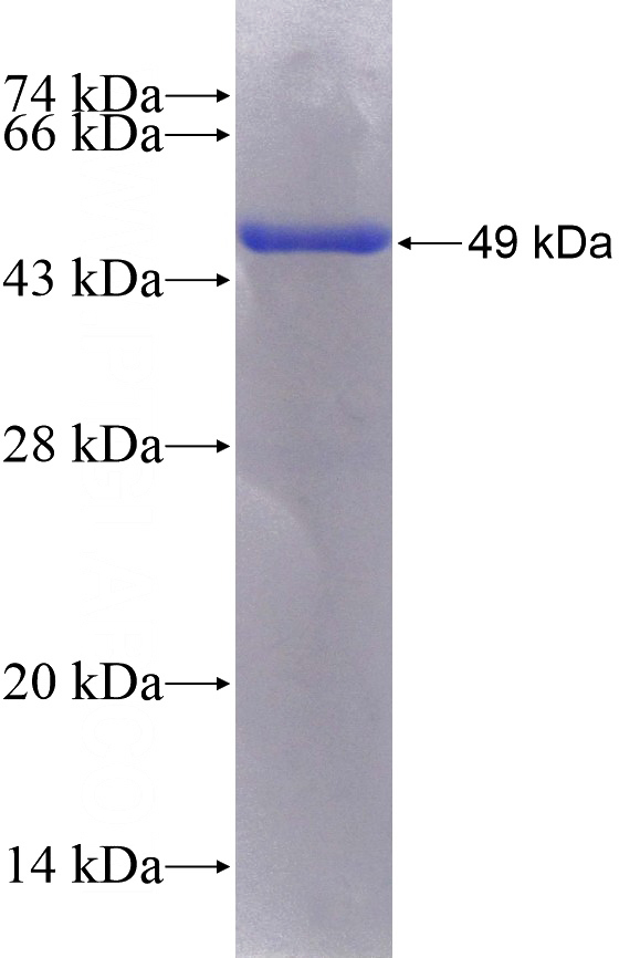 Recombinant Human RAB9A SDS-PAGE