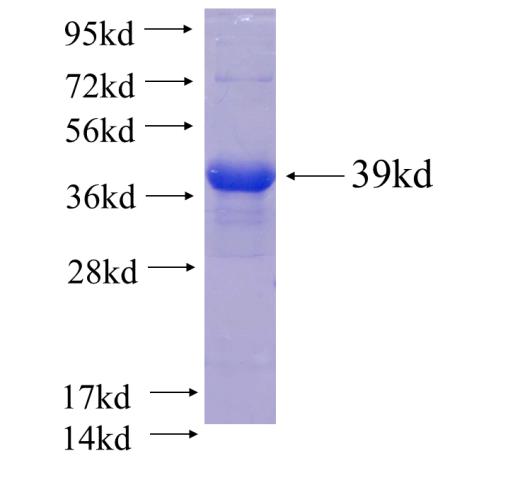 Recombinant human CCT5 SDS-PAGE