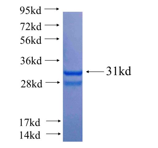 Recombinant human SLC25A37 SDS-PAGE