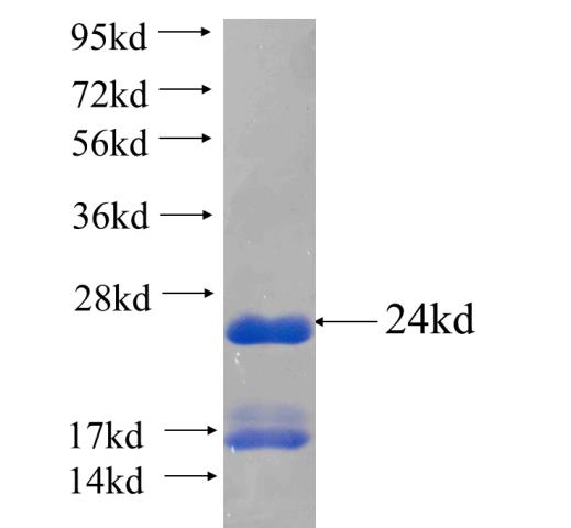 Recombinant human MBP(Full length) SDS-PAGE