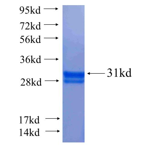Recombinant human KRT14 SDS-PAGE