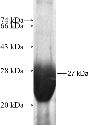 Recombinant Human SLC39A5 SDS-PAGE
