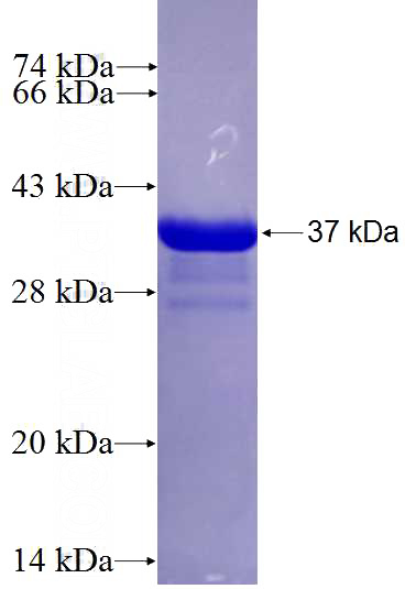 Recombinant Human EOMES SDS-PAGE