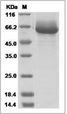 Mouse Alkaline Phosphatase / ALPL Protein (His Tag) SDS-PAGE