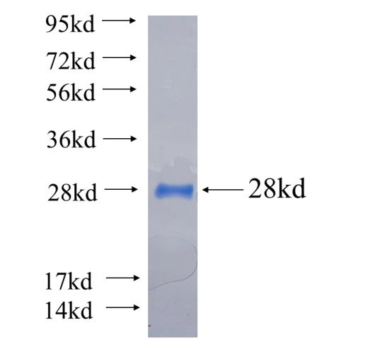 Recombinant human CYP26B1 SDS-PAGE