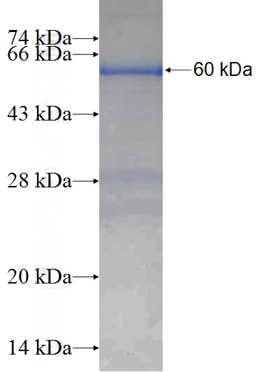 Recombinant Human ZNF473 SDS-PAGE