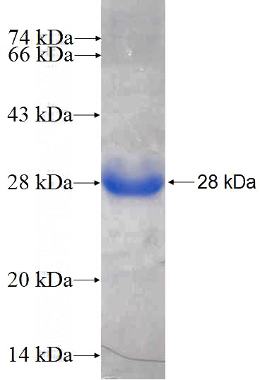 Recombinant Human MRPS18A SDS-PAGE