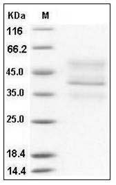 Mouse TNFRSF17 / BCMA Protein (His & Fc Tag) SDS-PAGE