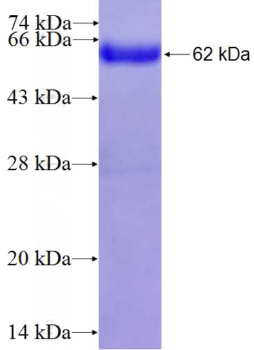 Recombinant Human GABBR2 SDS-PAGE