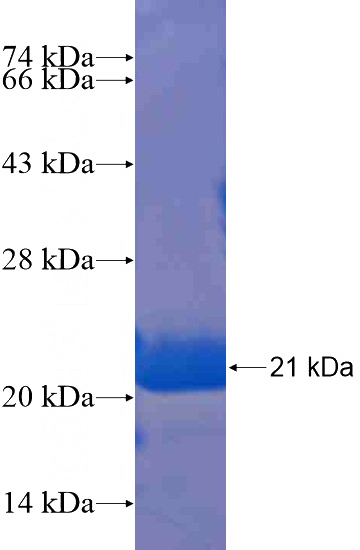 Recombinant Human STRN3 SDS-PAGE