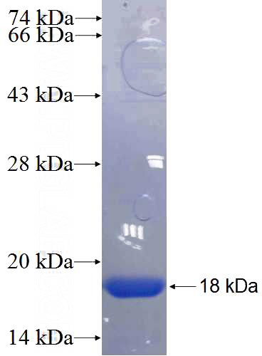 Recombinant Human RFX2 SDS-PAGE