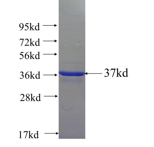 Recombinant human REEP4 SDS-PAGE