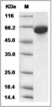 Human SAE1 Protein (His & GST Tag) SDS-PAGE