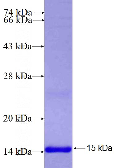 Recombinant Human AGAP3 SDS-PAGE