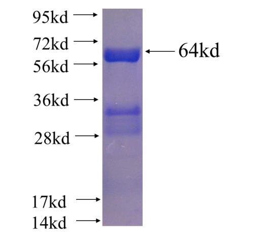 Recombinant human RARA SDS-PAGE