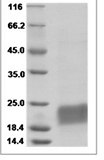 Human CD3e/CD3 epsilon Protein 14761