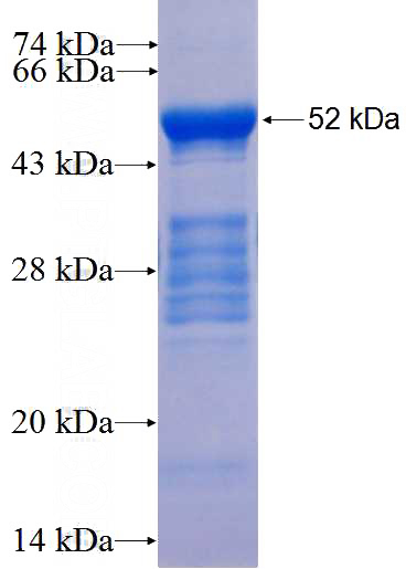 Recombinant Human NEUROG1 SDS-PAGE