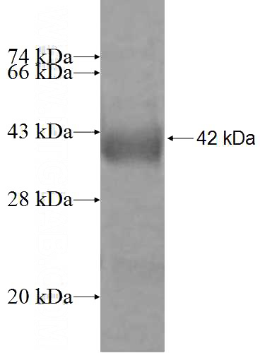 Recombinant Human FARS2 SDS-PAGE