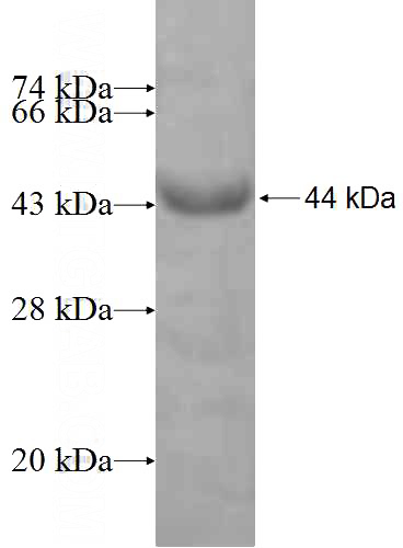Recombinant Human VILL SDS-PAGE