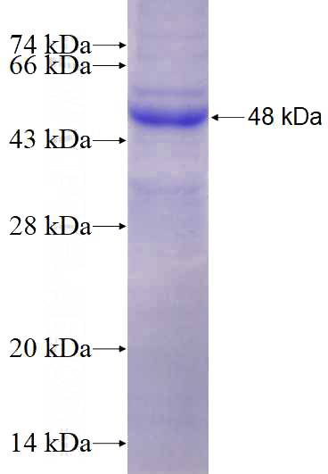 Human DNAJB9 Recombinant protein (GST tag)