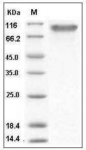 Human PDGFRa / CD140a Protein (His Tag) SDS-PAGE