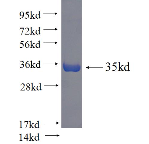 Recombinant human ANKDD1A SDS-PAGE