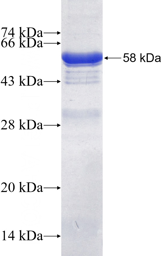 Recombinant Human FKBPL SDS-PAGE