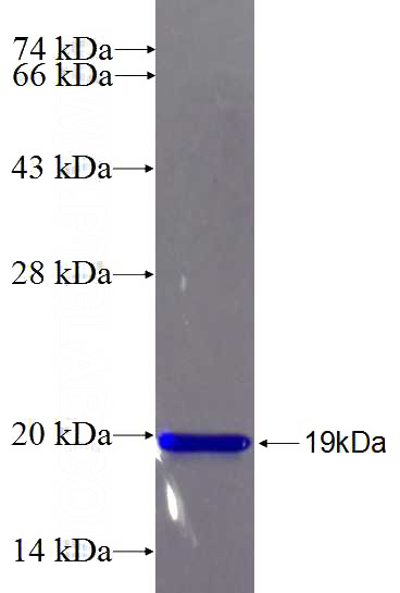 Recombinant Human ADAM22 SDS-PAGE