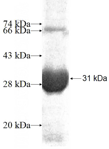 Recombinant Human PYCRL SDS-PAGE
