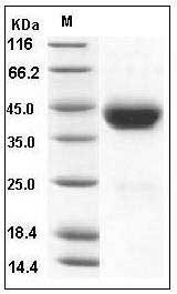Mouse CD38 Protein (His Tag) SDS-PAGE