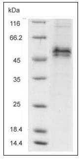Mouse Follistatin / FST Protein (His Tag) SDS-PAGE