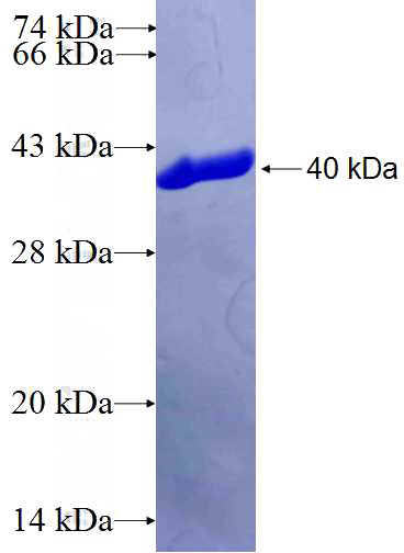 Recombinant Human OPA1 SDS-PAGE