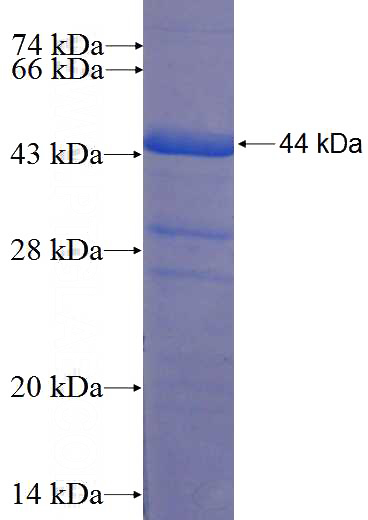 Recombinant Human TCF19 SDS-PAGE