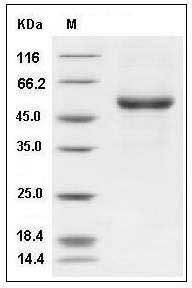 Human EDAR / DL Protein (Fc Tag) SDS-PAGE