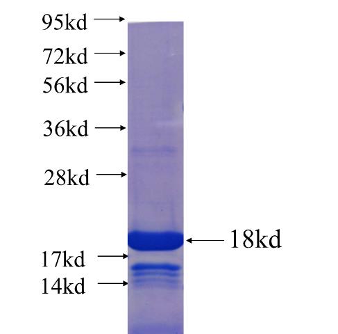 Recombinant human BCAR3 SDS-PAGE
