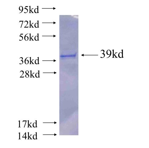 Recombinant human CC2D1B SDS-PAGE