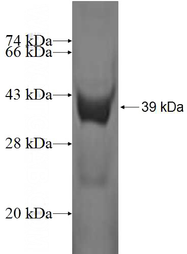 Recombinant Human SH3BGRL SDS-PAGE