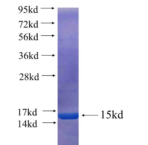 Recombinant human VANGL2 SDS-PAGE