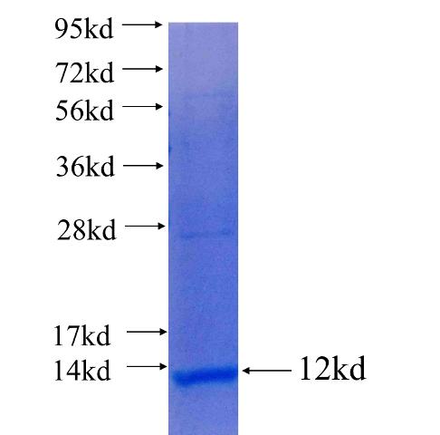 Recombinant human SLC12A7 SDS-PAGE