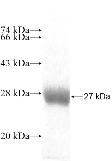 Recombinant Human RAB43 SDS-PAGE