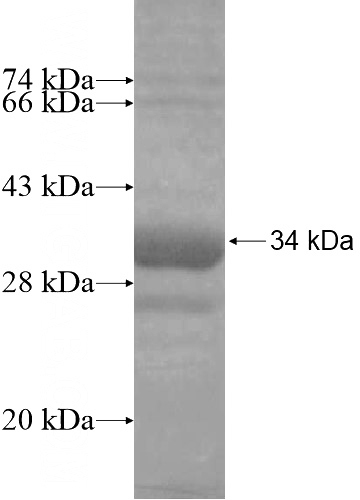 Recombinant Human C4BPB SDS-PAGE