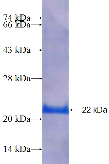 Recombinant Human PIGZ SDS-PAGE