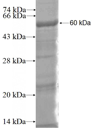 Recombinant Human PLAA SDS-PAGE