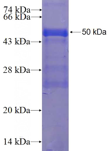 Recombinant Human ZNF165 SDS-PAGE