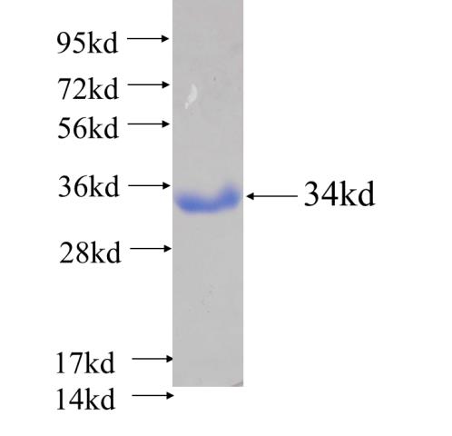Recombinant human CLE; C14orf166(Full length) SDS-PAGE
