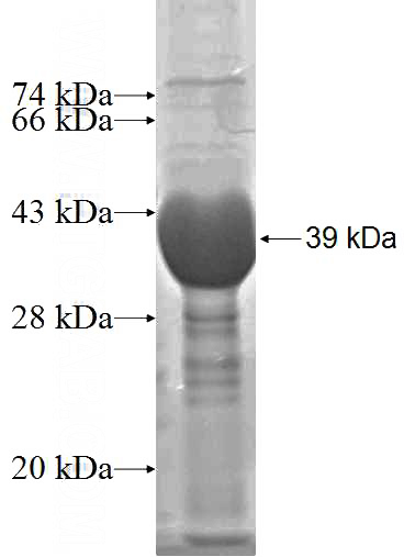 Recombinant Human RDX SDS-PAGE