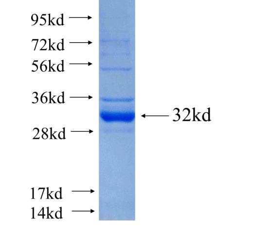 Recombinant human ACAP1 SDS-PAGE