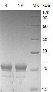 Mouse Cxcl15/Scyb15 (His tag) recombinant protein