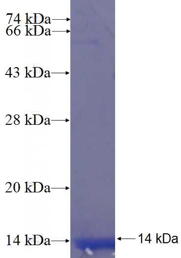 Recombinant Human ANXA8 SDS-PAGE